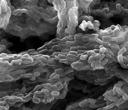 SEM micrograph of the ordered mesoporous carbon particles