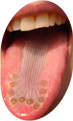 E-tongue: an artificial taste sensor for mimicking human sensory perception