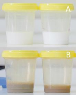 Developed base-PUD (A) and PUD added with antimicrobial extracts (B)