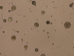Final microspheres incorporating extracts of Helychrisum stoechas, produced by double emulsion/evaporation method (OM)