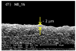 SEM micrograph of a Beta membrane: cross section view